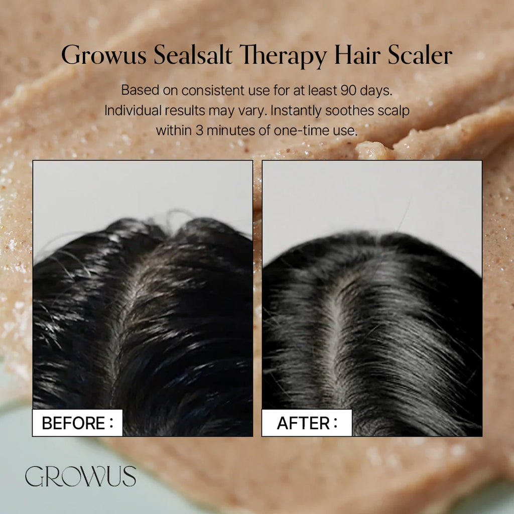 GROWUS - Sea Salt Therapy Scalp Scaler - Peeling, 250 ml - Seoulma-skincare