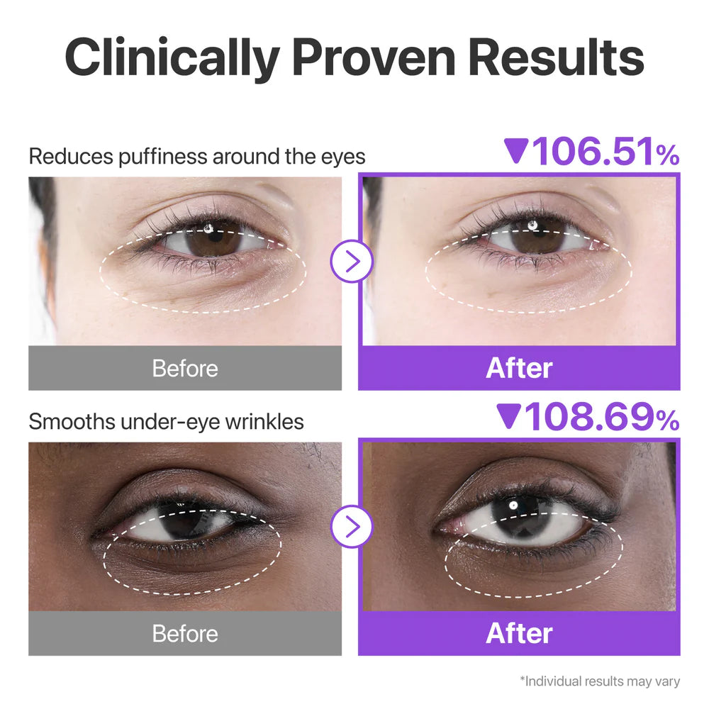 Numbuzin – No.9 NAD+ Eye Patches, 5 pairs - Seoulma-skincare