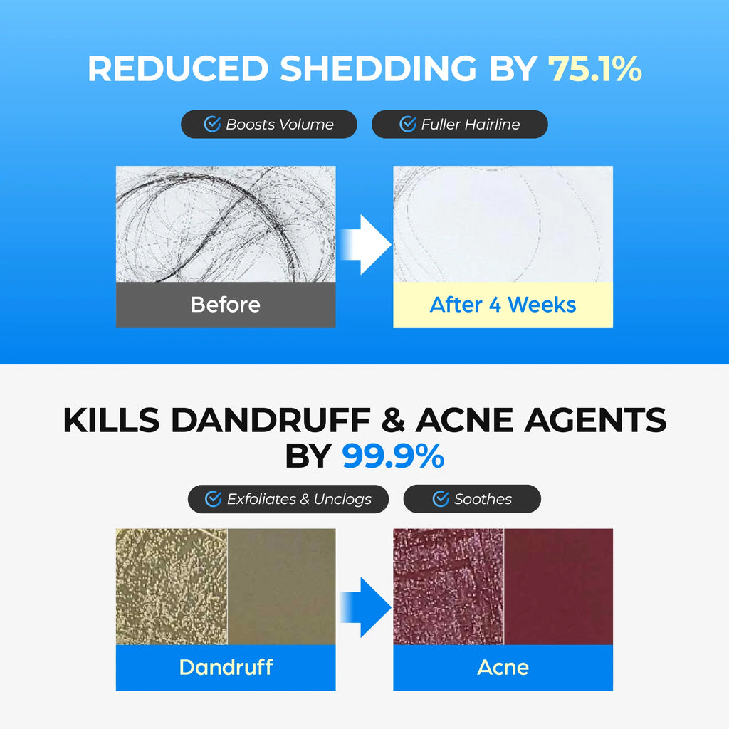 Seapuri - Scalpy Bubble Tonic - Strengthening and Exfoliating Scalp Tonic - 100ml - Seoulma-skincare