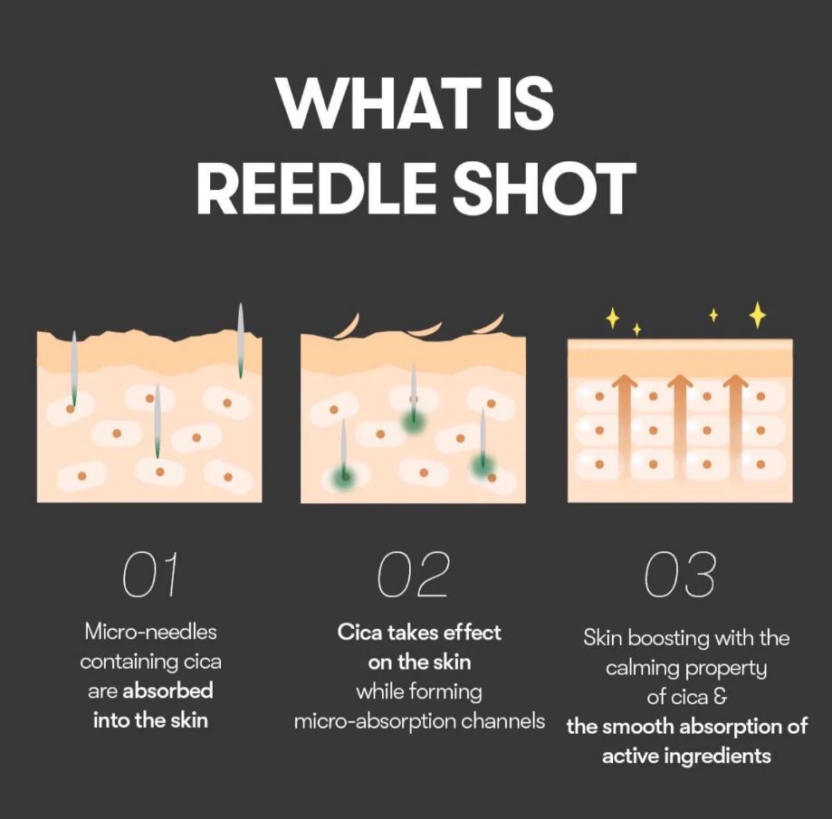 VT Cosmetics – Reedle Shot 300, 30ml - Seoulma-skincare
