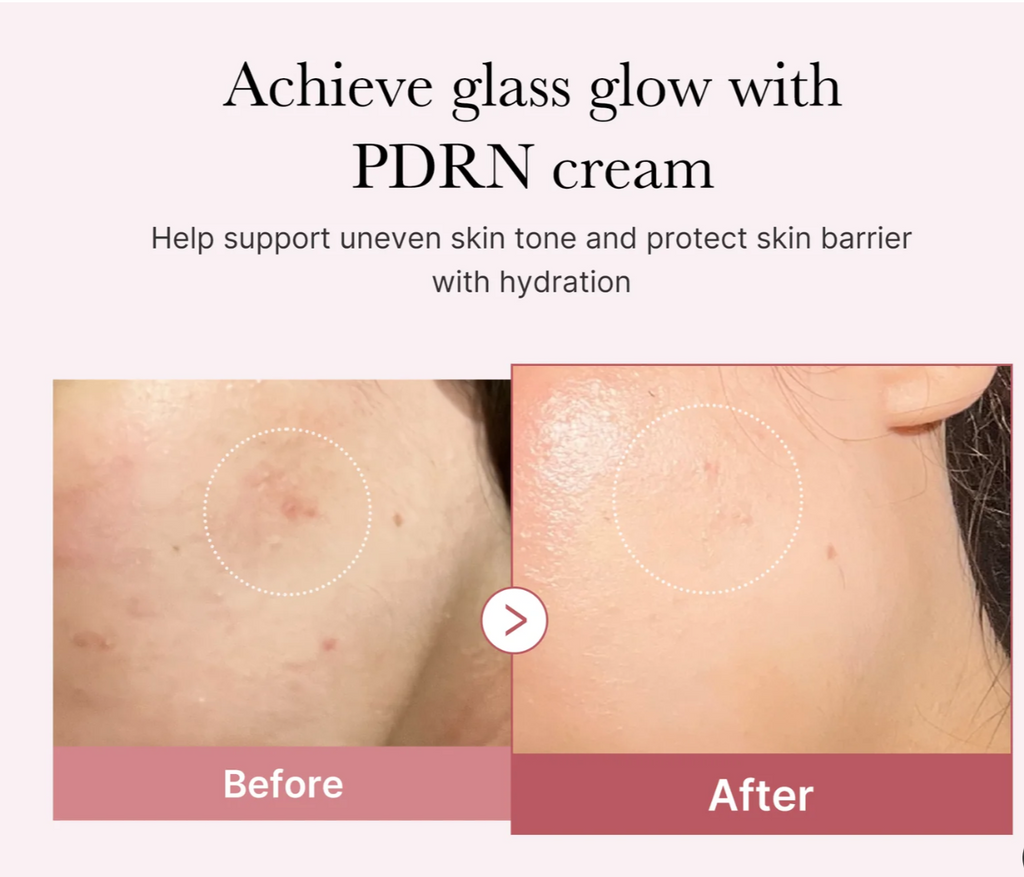 Medicube Salmon DNA PDRN Pink Hyaluronic Cream, 50ml