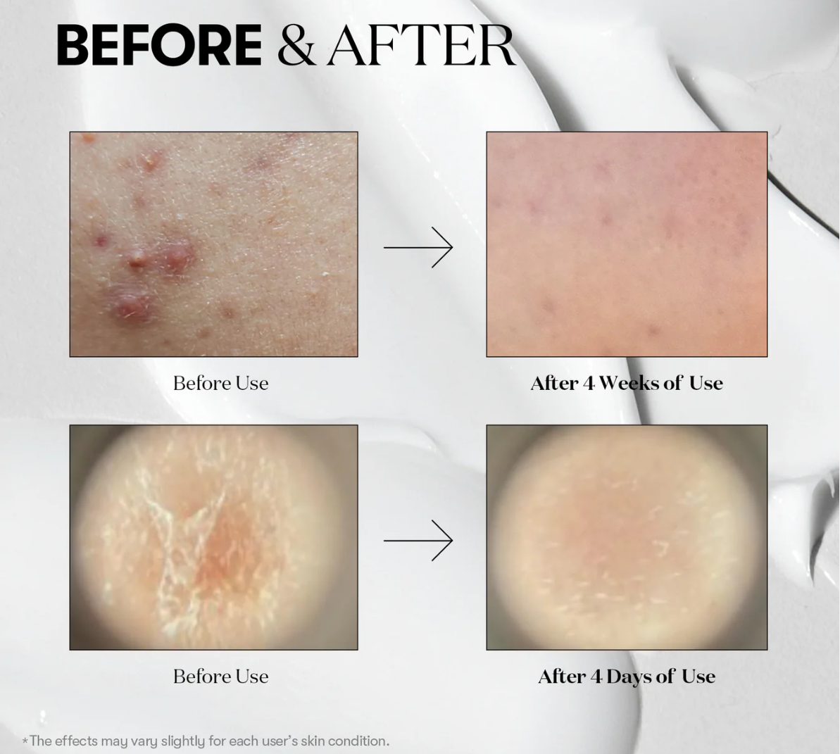 VT Cosmetics – Reedle Shot 300, 30ml - Seoulma-skincare